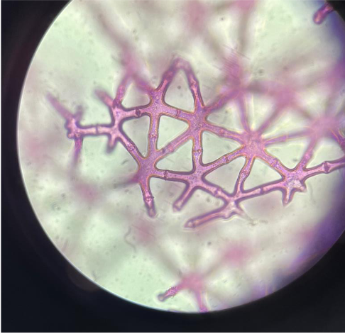 Sternparenchymzellen von Juncus effesus (Binse)